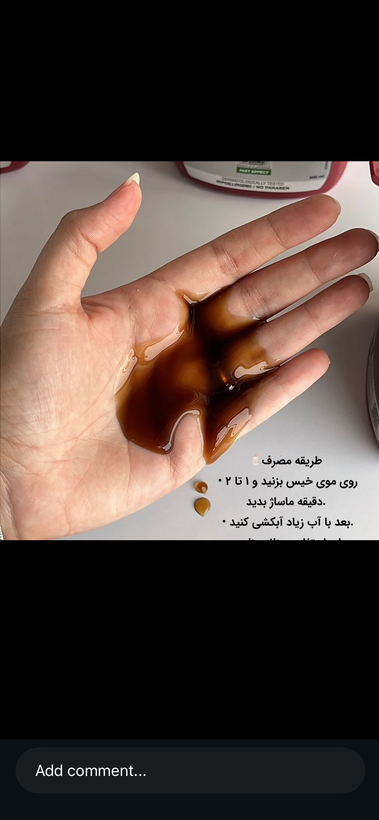 شامپو ضد ریزش مو بیوکسین مدل فورته حجم 300 میلی لیتر